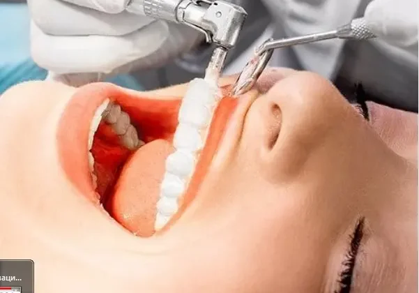Профессиональная гигиена полости рта, удаление зубного камня с последующей полировкой. Гигиеническая чистка зубов.