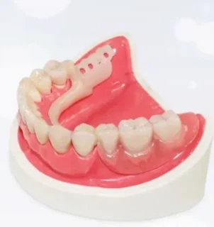 Фото для Несъемное протезирование: Восстановление зуба ацеталовой коронкой