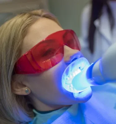 Профессиональное отбеливание зубов системой Opalescence Boost