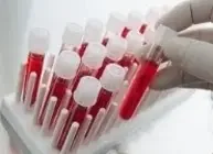 Фото для Анализ крови на Креатинин, Мочевая кислота