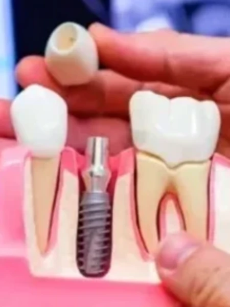 Фото для Консультация стоматолога-хирурга для взрослых