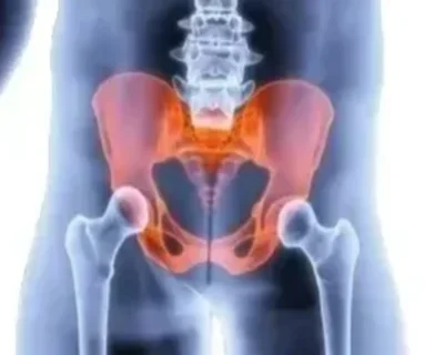 Компьютерная томография органов таза у мужчин