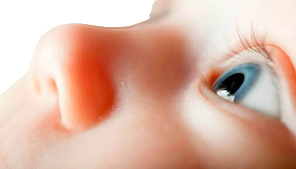 Офтальмоскопия (глазное дно, дети до 1,5 лет)