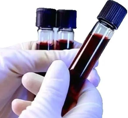Исследование уровня свободного тироксина сыворотки (Т-4) крови ИФА методом