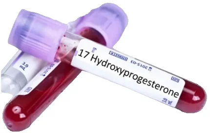Фото для Исследование уровня 17-гидроксипрогестерона в крови