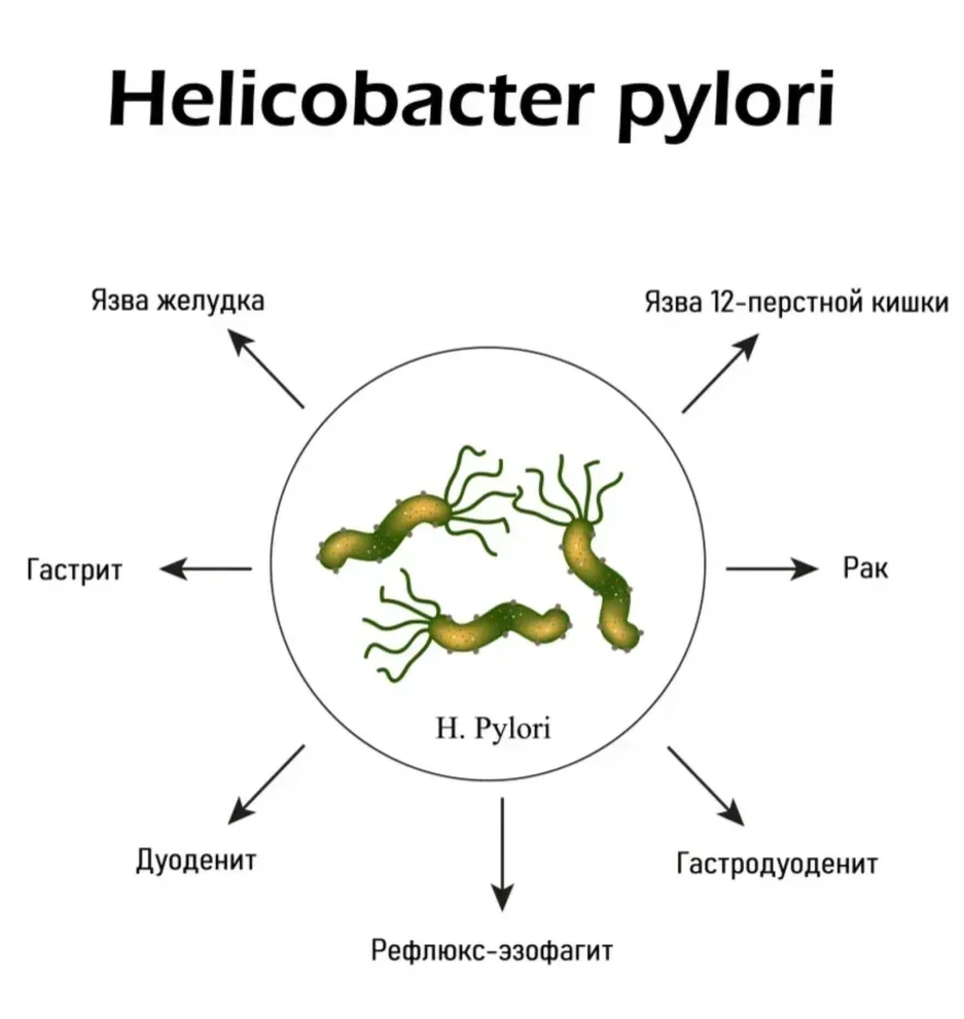 Антитела к Helicobacter pylori: иммуноферментный анализ. Helicobacter Pylori IgM (антитела класса IgM к Helicobacter pyl