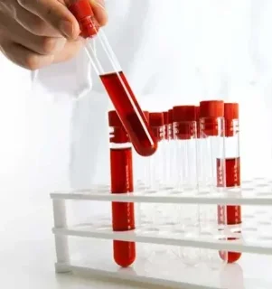 Фото для Общий анализ крови (без лейкоцитарной формулы и СОЭ)